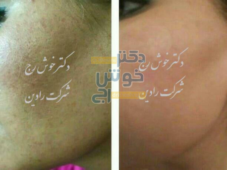 منافذ پوست صورت